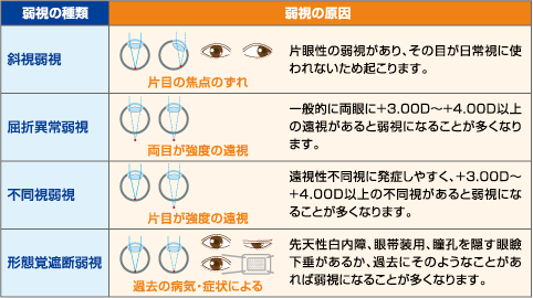 弱視 みま眼科 港区新橋 内幸町駅1分 新橋駅3分 虎ノ門駅8分 の眼科